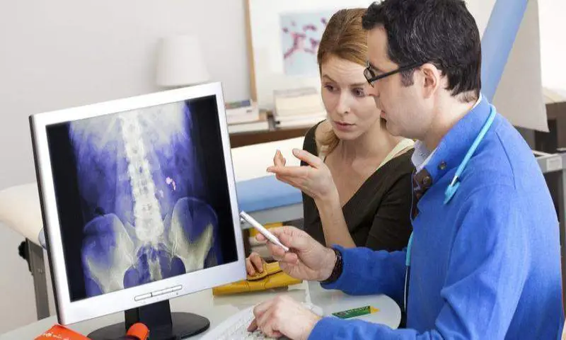 Shattering Myths About Kidney Stones
